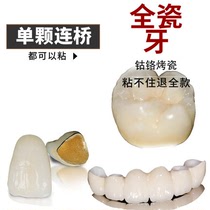 牙科自己动手粘烤瓷牙胶水牙齿钢牙套牙冠假牙专用牙科胶水粘接剂
