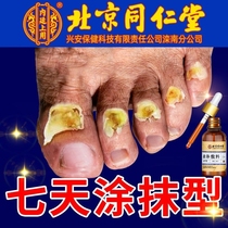 北京同仁堂灰指甲专用指甲刀炎矫正器正品脱甲膏抑菌液健康灰甲