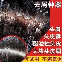毛囊炎 头痒专用儿童宝宝洗发水 头皮有疙瘩头屑严重去屑药用止痒
