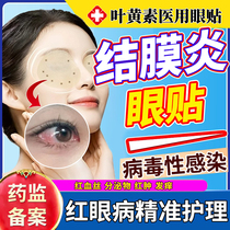 医用冷敷贴结膜炎眼罩眼睛红血丝修复去除过敏性红眼病冰敷眼贴YM