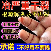 专治手裂的药膏防皲裂防裂膏冬季手干燥手指开裂脱皮粗糙干裂专用